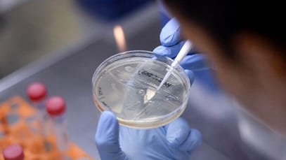 Il vaccino made in Italy prosegue la sperimentazione: “60 milioni di dosi entro l’anno” | Euronews